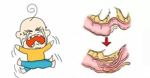 宝宝几天不拉屎是便秘了吗,宝宝一天不排便就便秘怎么办