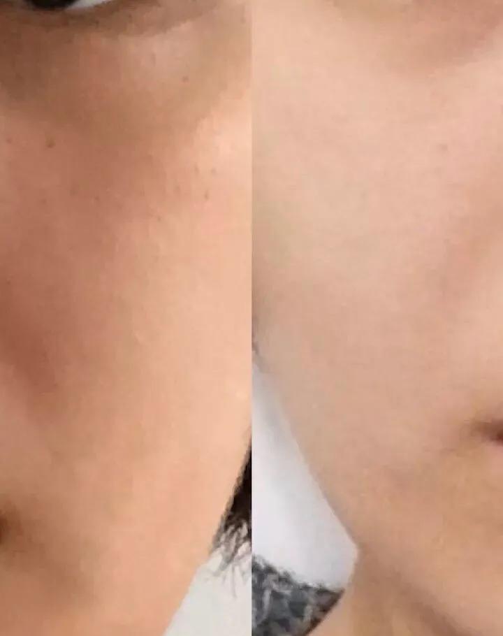 鎬庢牱璋冪悊鐨偆鏆楅粍,渚跨鐨偆鏆楅粍鎬庝箞璋冪悊