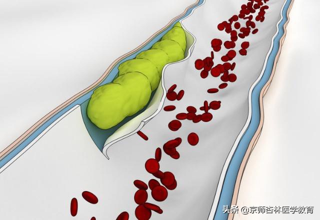 执业医师考试脑部疾病,执业医师考试诊断学考点