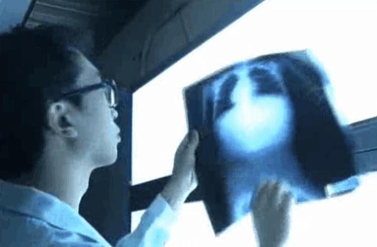 83天核事故救治纪录片,核灾83天死亡全记录