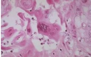 猫鼻支是怎么诊断的，又该怎么办呢？|猫鼻支治疗方法一览