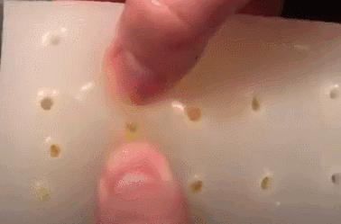 腋下痘痘挤出白色米粒是什么,痘痘里面挤出小米粒是不是就好了