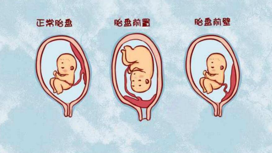 怀孕正确抚摸肚子的方法,怀孕了如何正确抚摸肚子