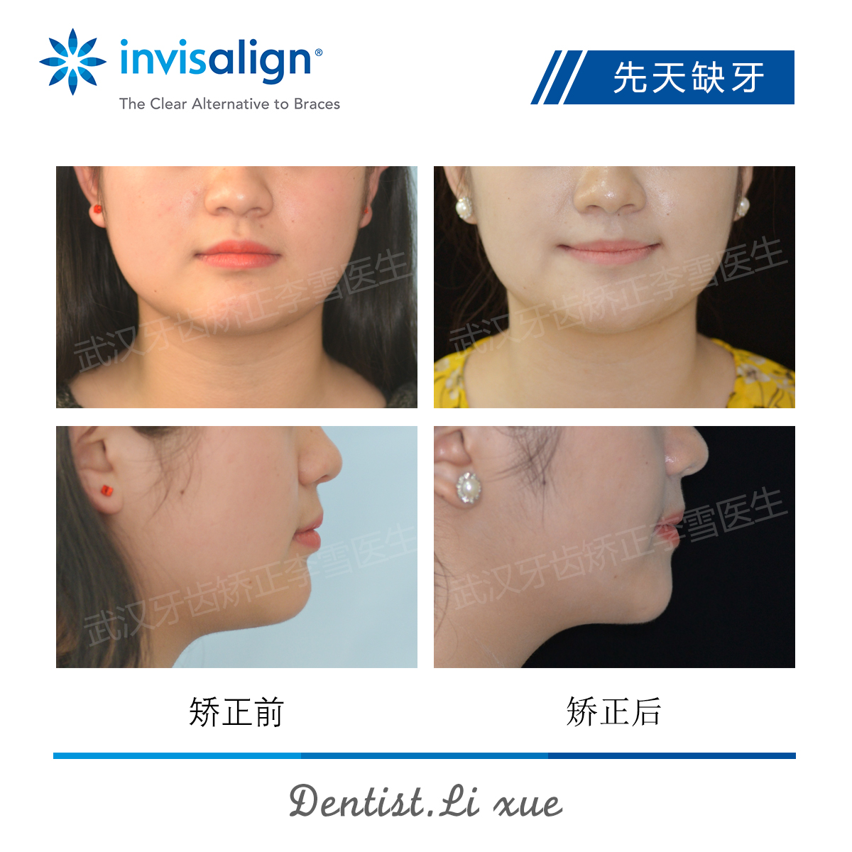 武汉牙齿矫正整形医生,武汉牙齿矫正医生推荐