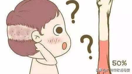 宝宝出汗多怎么预防感冒,宝宝出汗多怎么推拿调理