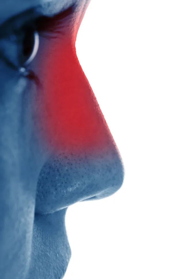 焦虑引起过敏,焦虑性过敏怎么办