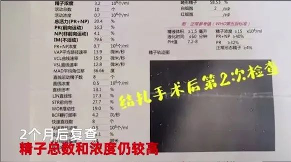 丈夫结扎妻子怀孕,太扎心男子2次结扎妻子怀孕