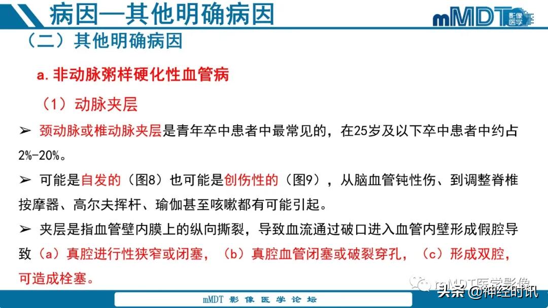 急性缺血性脑卒中ppt素材图片,青年缺血性脑卒中ppt