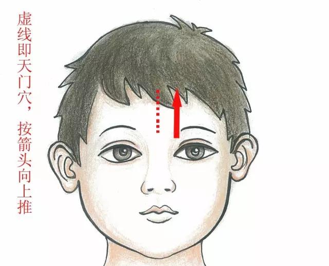 小儿推拿处理积食发烧,小儿推拿积食发烧效果好吗