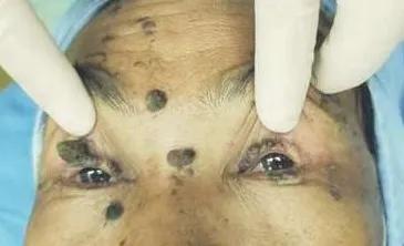 龙岩二院眼科预约电话,龙岩二院眼科在东院吗