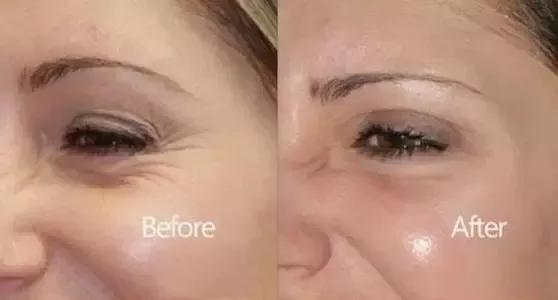 雅诗兰黛日本产的眼霜,用了雅诗兰黛皱纹更明显了