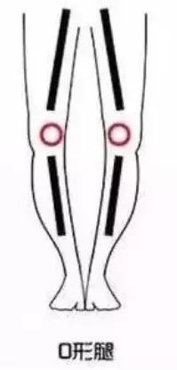 腿型不好会显短吗,牛仔裤哪个版型显高显瘦修饰腿型