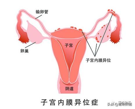 经期遇上浑身疼痛怎么办,经期闹心怎么缓解