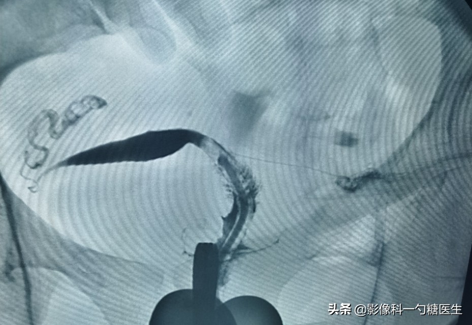 从14岁到17岁,从14岁到22岁