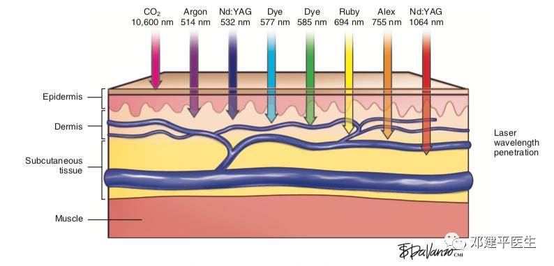 鼻子激光治疗毛细血管扩张多少钱,鼻子红毛细血管扩张激光治疗视频