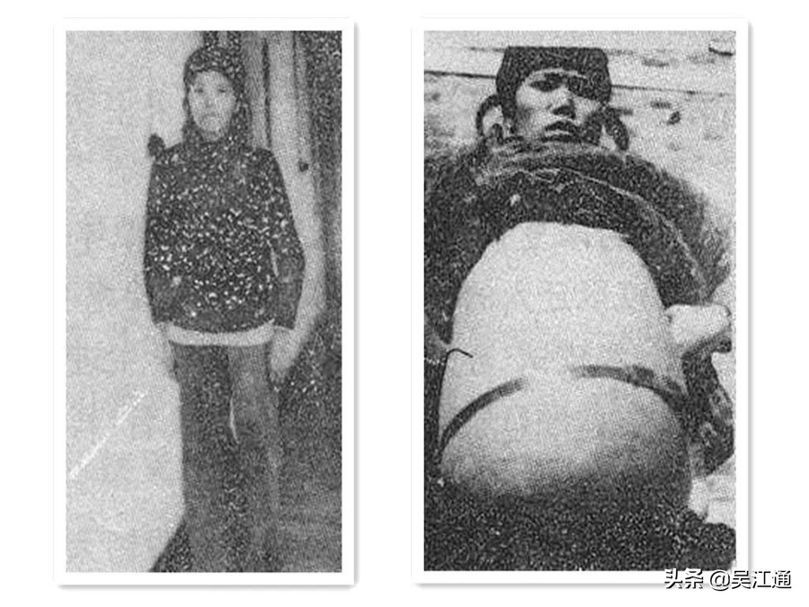 鎴戠粡鍘嗙殑鐤儏,鎴戠粡鍘嗙殑鎶楃柅鏁呬簨