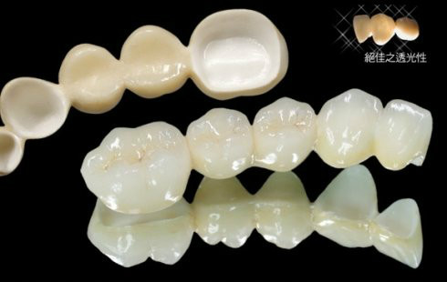 各种假牙价格一览表,假牙十大品牌价格表