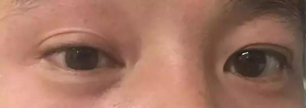 一针治百种病症 (一针治100种病症)