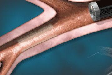 医生手术后最想做什么,医生做完手术以后会怎样