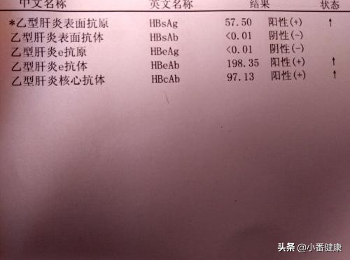 乙肝五项第5项阳性属于小三阳吗,乙肝小三阳乙肝五项数值怎么看