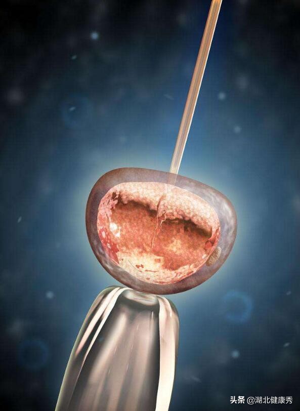 试管婴儿移植两次失败了什么原因,试管婴儿移植4aa囊胚失败