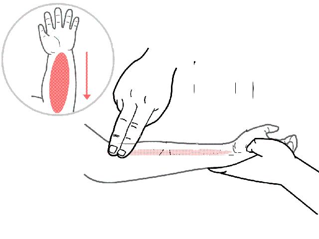 一个月的宝宝便秘怎么快速排便,小便正常大便便秘严重怎么调理