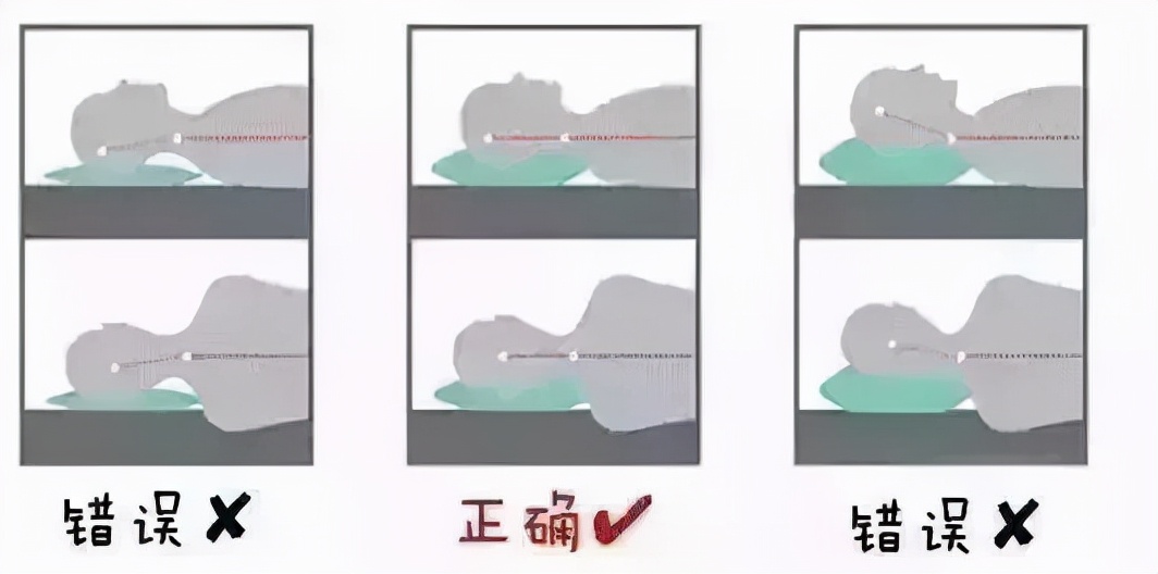 头晕头痛胸闷交感型颈椎病,交感神经型颈椎病头晕的中医辨证