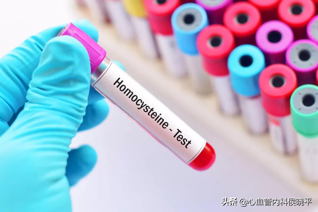 高血压患者叶酸值多少应补充,同型半胱氨酸高血压叶酸补多少