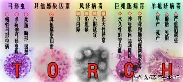 备孕担心孩子畸形需要做什么检查,备孕胎儿畸形