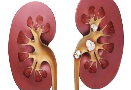 尿尿起沫肾不好吗,尿蛋白高尿尿起泡沫吗