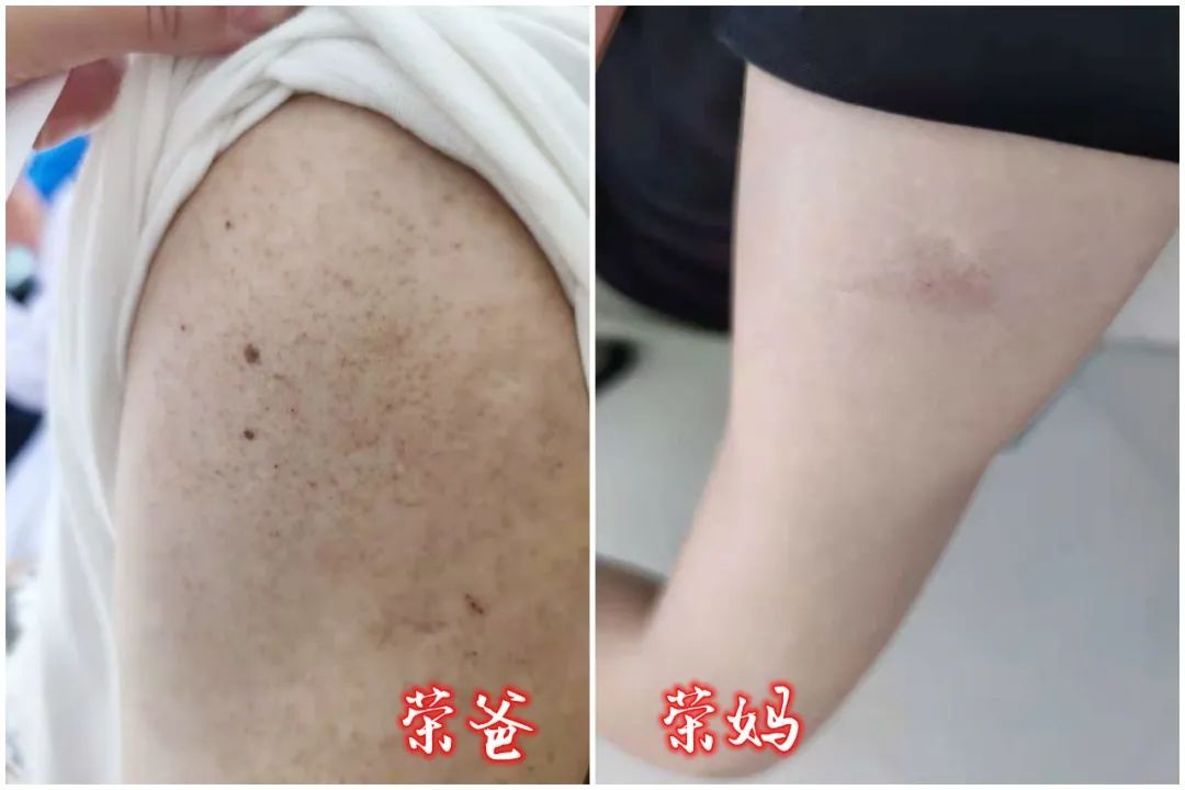 打完新冠疫苗的感觉真好,接受新冠疫苗后的感觉