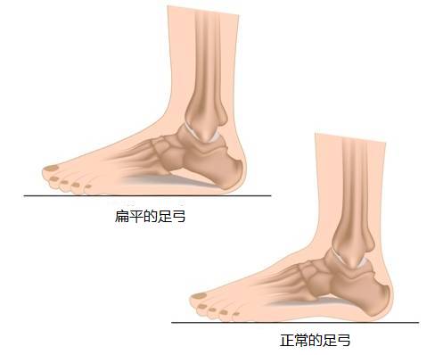 根基建立必练的16体式讲解,根基不稳
