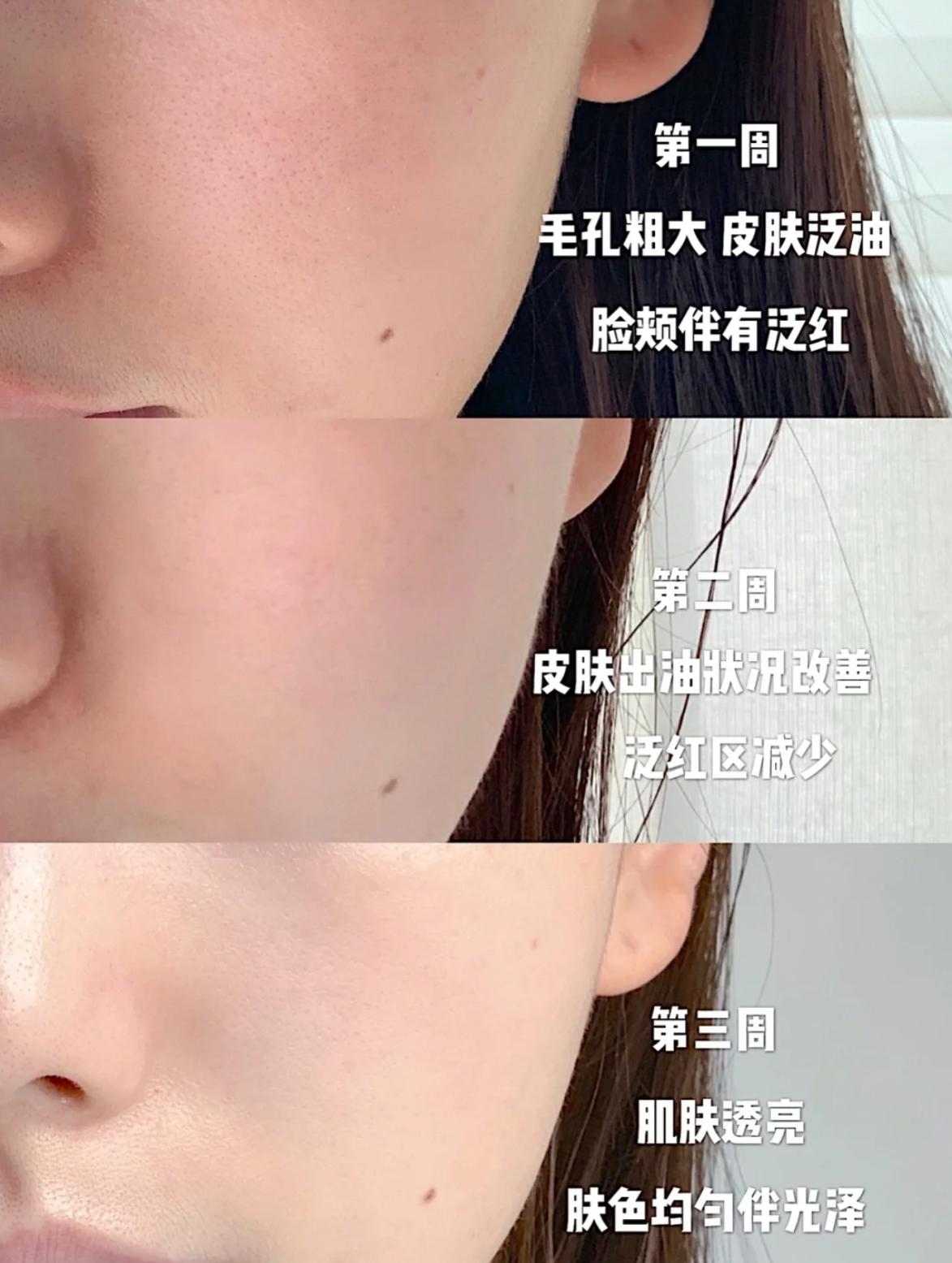 长期去美容院的女人，坚持10年会有哪些变化？网友：不敢信