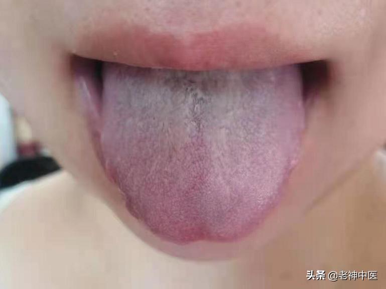 奶水不足气血不足吃什么中药,奶水不足吃什么最快最补奶