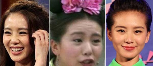 长期吃胶原蛋白保健有什么副作用,女人长期服用胶原蛋白会有皱纹吗