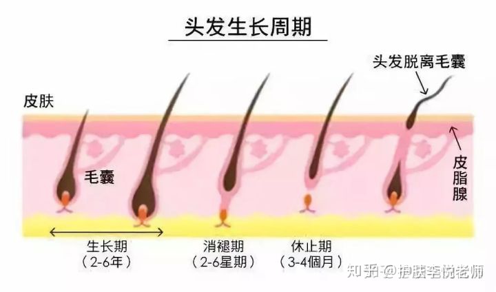 唇毛真的能彻底去掉吗,唇毛多怎么去掉不用脱毛膏