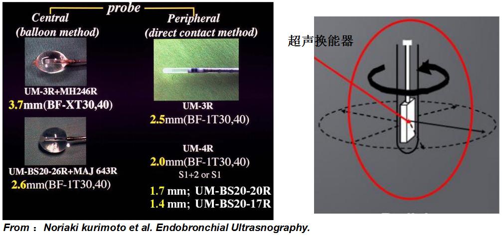 孙加源门诊,治疗肺癌的新技术新手段