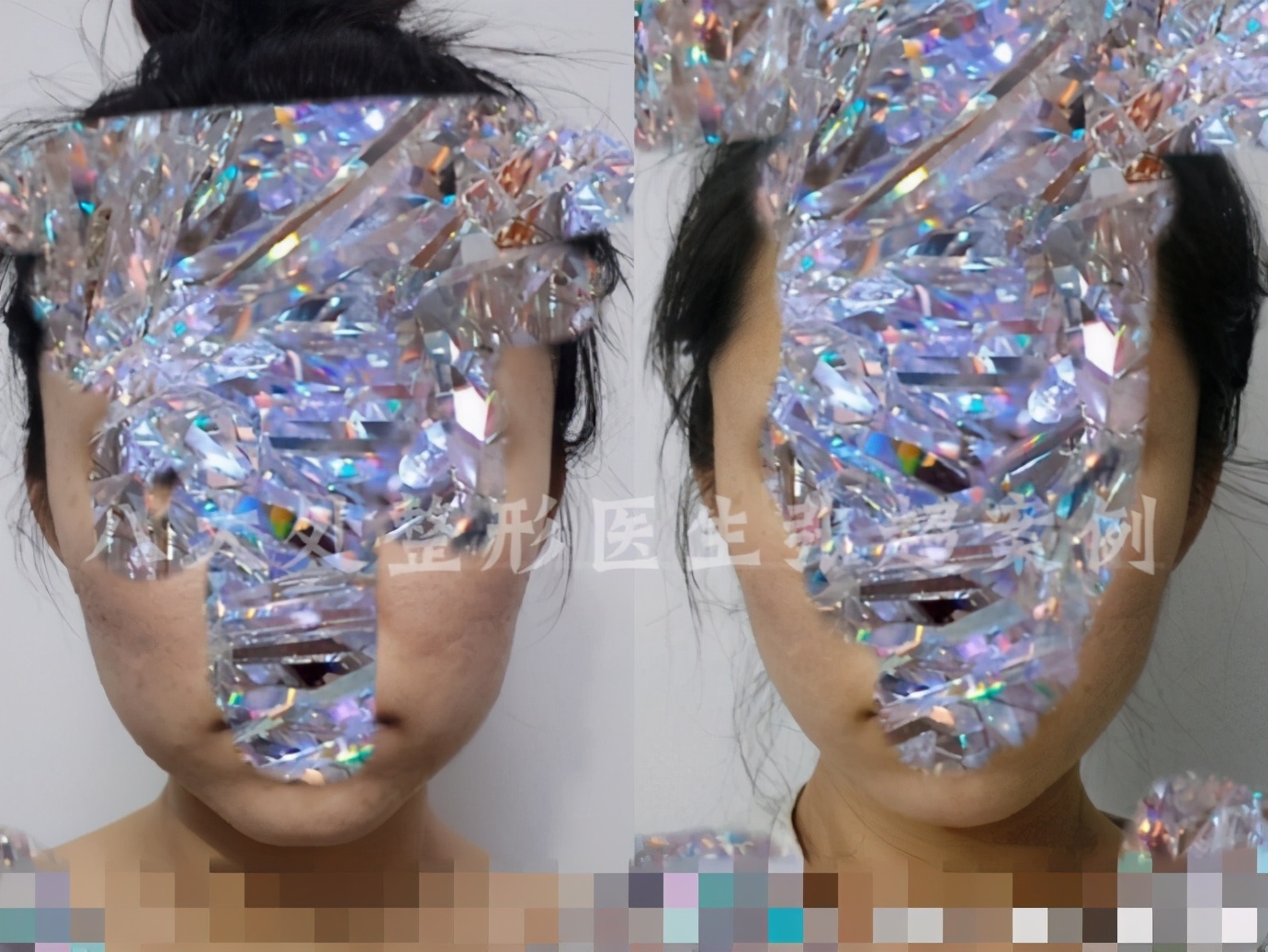 八大处整形张超,八大处张超最新视频