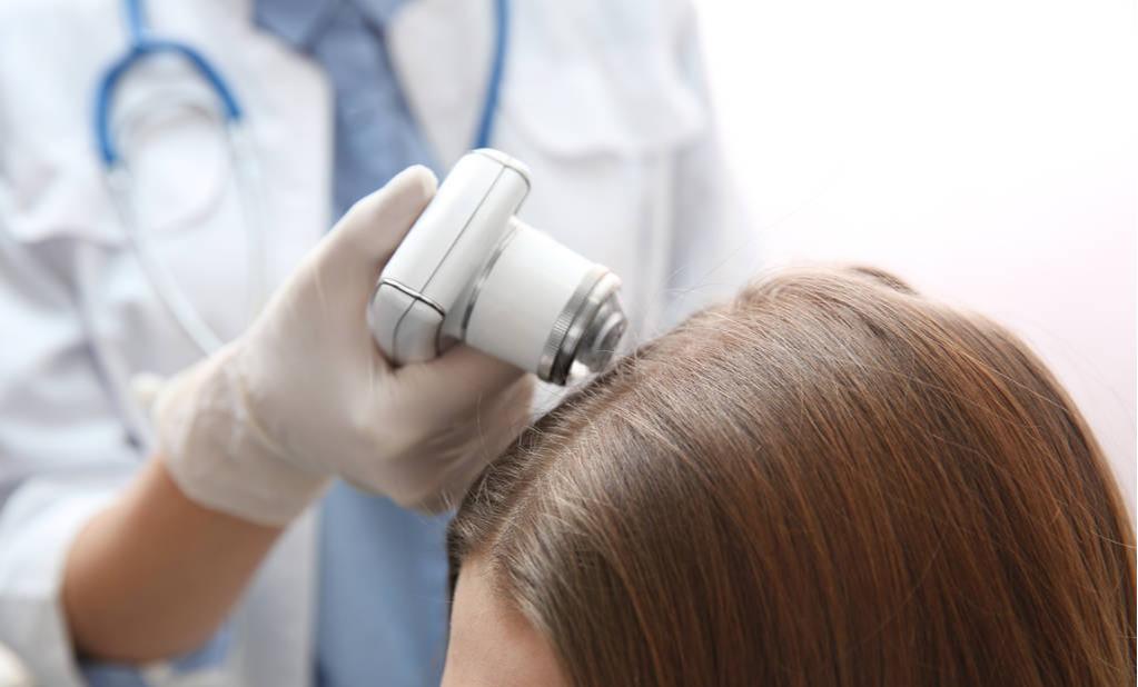 雄激素性脱发是一种病吗,雄激素性脱发什么造成的