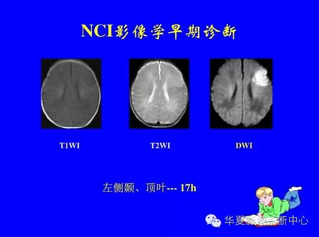 新生儿颅脑mri,新生儿颅脑mr报告模板