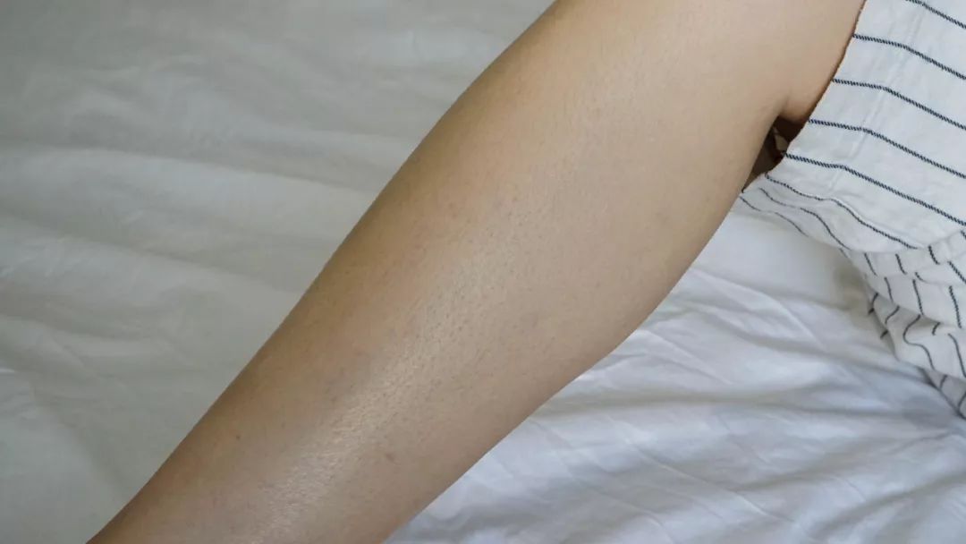 全网最好用的脱毛方法,脱毛最经济实惠