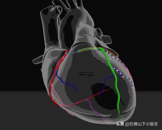 跟陈大夫学看冠脉，看一下人体的冠脉是怎么样的