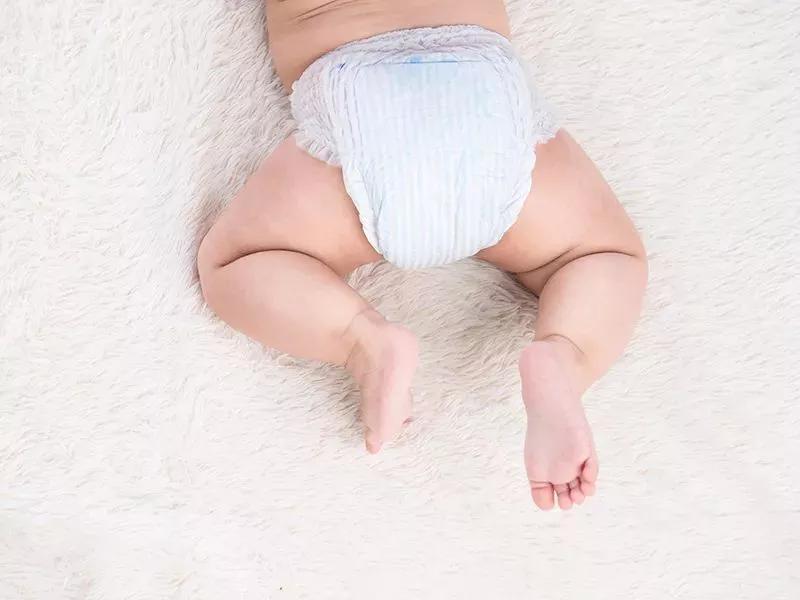 宝宝脚趾甲往肉里长怎么剪,宝宝脚趾甲长到肉里怎么办