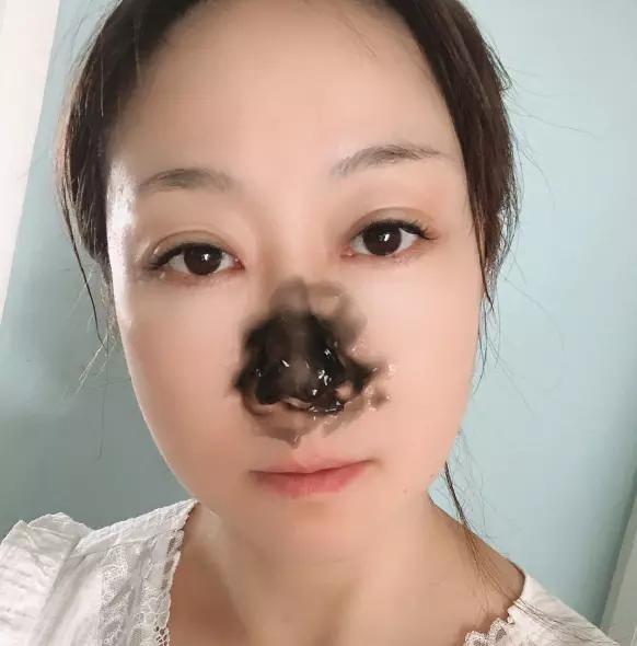 鼻头浮粉怎么快速解决,鼻子油脂粒和黑鼻头的区别