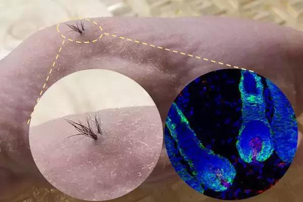 诺奖成果,头发再生最新研究成果