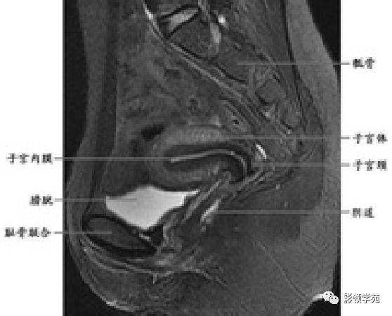宫颈癌mri诊断,宫颈癌的mr扫描技术