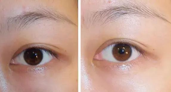 护肤太多的坏处有哪些呢,护肤越补越糟糕