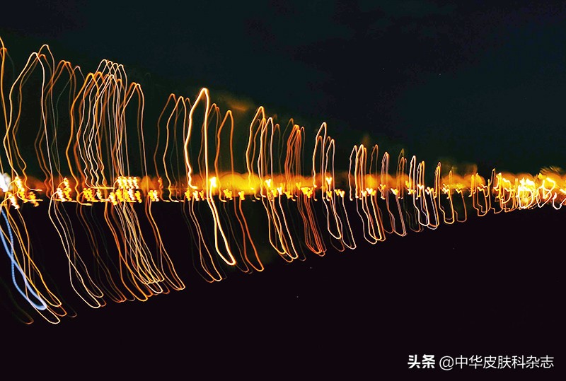 白癜风光疗用什么灯,白癜风家用光疗效果好吗