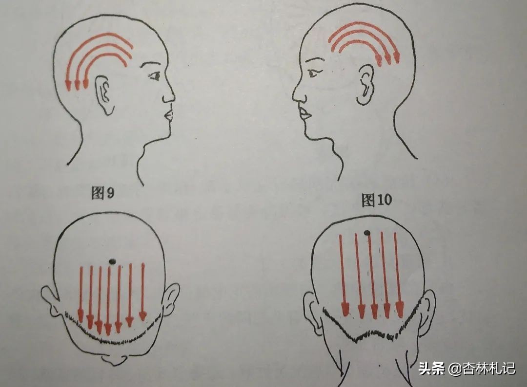 面部刮痧如何刮痧才有最佳效果,脸部怎么刮痧才是正确的方法