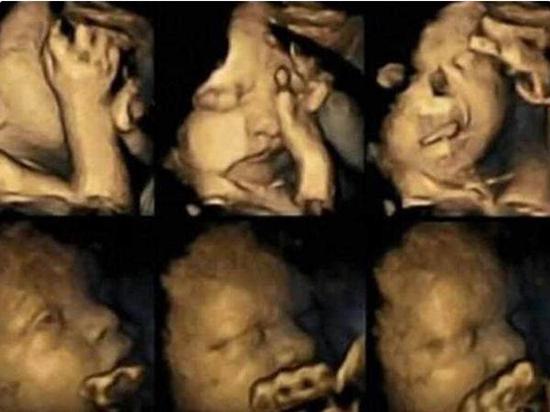 孕妇做四维彩超可以查出宝宝什么,孕妇四维彩超胎儿最佳状态